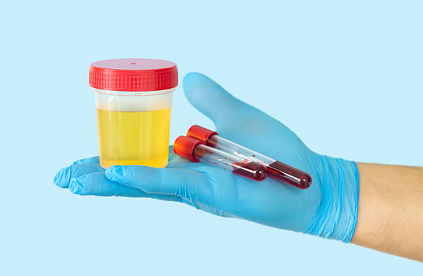 диагностика преждевременной эякуляции