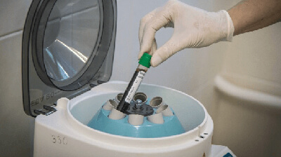 Плазмолифтинг